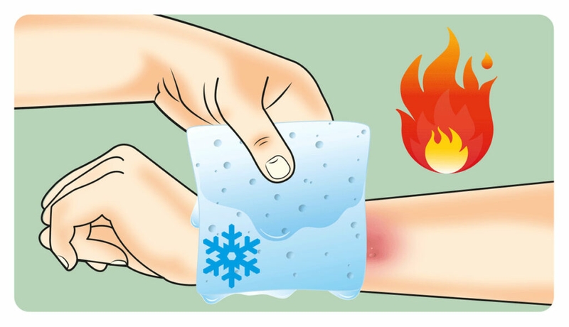 Bị bỏng bôi gì và không nên bôi gì để vết thương nhanh lành? 3