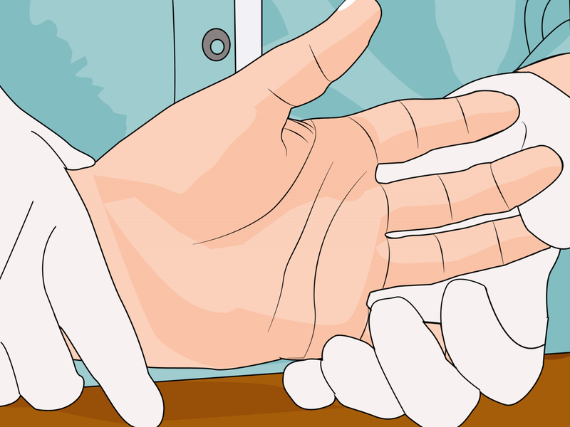 Khi các triệu chứng bong gân tiếp tục trở nên tồi tệ, bạn nên đến gặp bác sĩ chuyên khoa