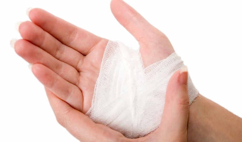 Bị cá ngát đâm làm sao hết nhức? Cách sơ cứu khi bị cá có độc tấn công 2