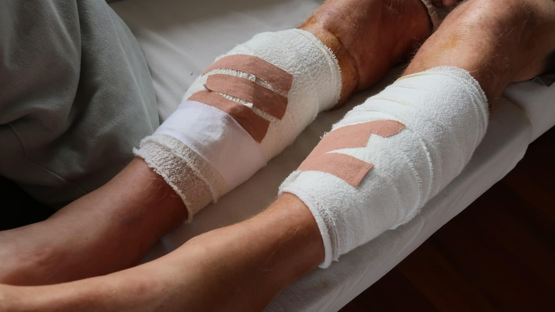 Bị chó cắn sau 20 ngày mới đi tiêm có được không?3