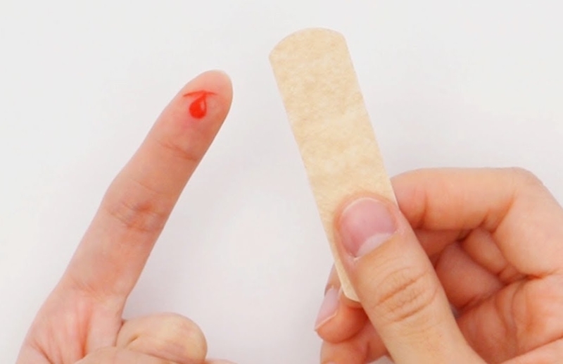 bị chó con cắn chảy máu có sao không 4