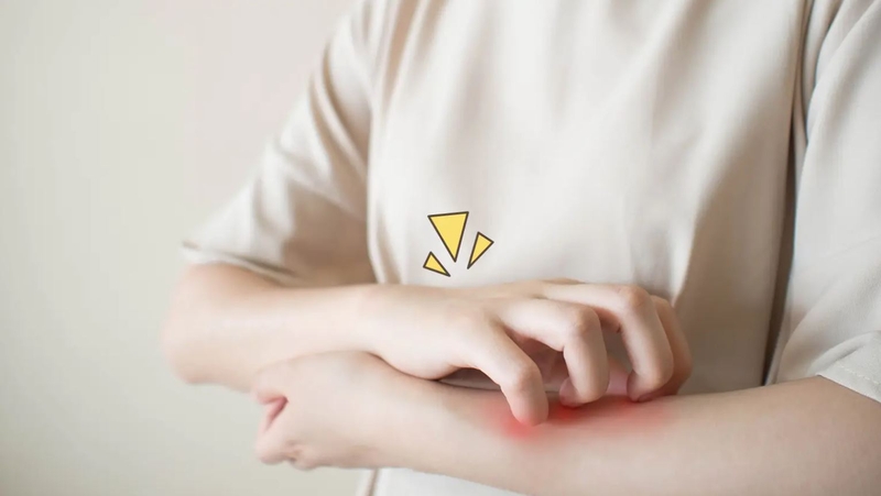 Bị côn trùng cắn sưng mủ nên làm thế nào là đúng? 1