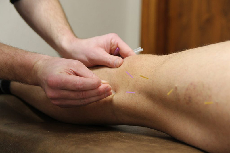 Bị đau khớp gối châm huyệt nào hiệu quả? 2