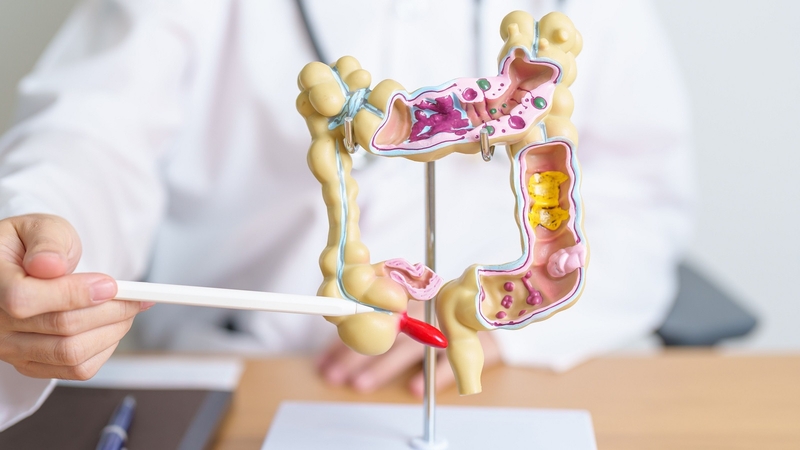 Bị đau ruột thừa nên làm gì? Có chữa tại nhà được không? 1