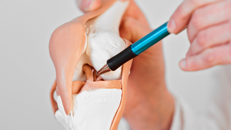 Bị đứt dây chằng chéo trước không mổ có sao không?