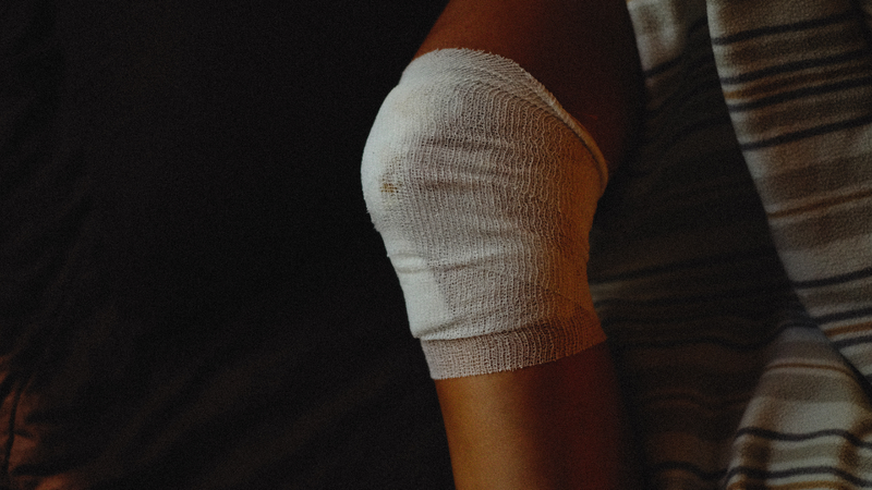 Phẫu thuật dây chằng chước để tái tạo dây chằng