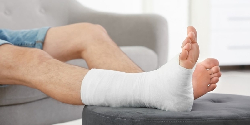 Bị gãy xương không bó bột có sao không Lưu ý khi bó bột gãy xương 1