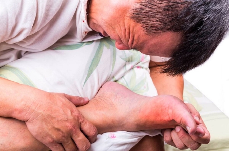 Bị gút có nên chườm đá lạnh không? Những điều bệnh nhân cần lưu ý 2