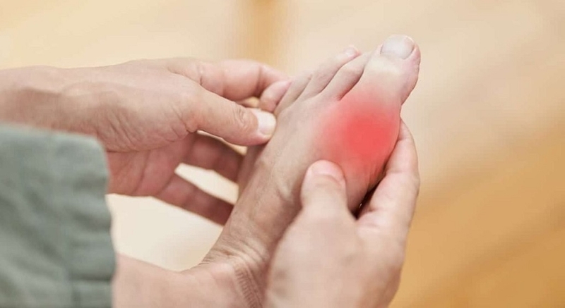 Bị gút có nên chườm đá lạnh không? Những điều bệnh nhân cần lưu ý 4