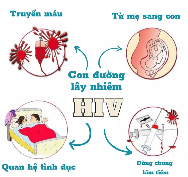 Bị hiv có đi nước ngoài được không? -1