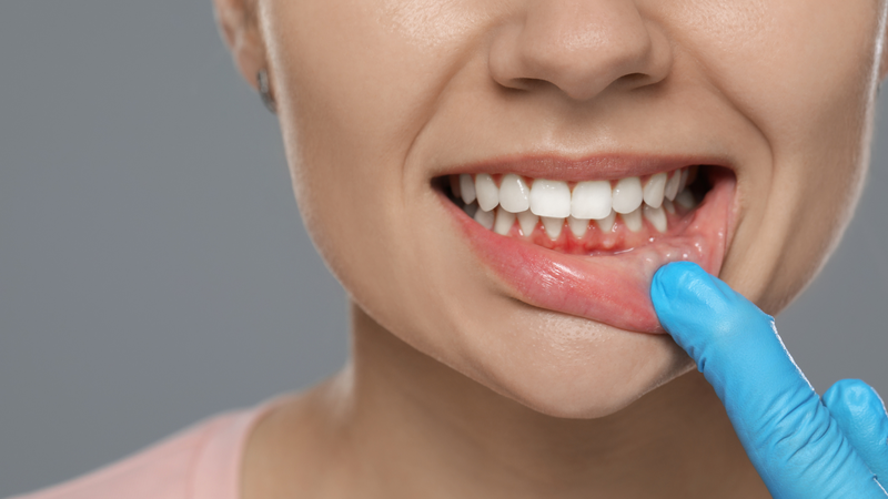 Cần hiểu rõ nguyên nhân dẫn đến tình trạng hở chân răng