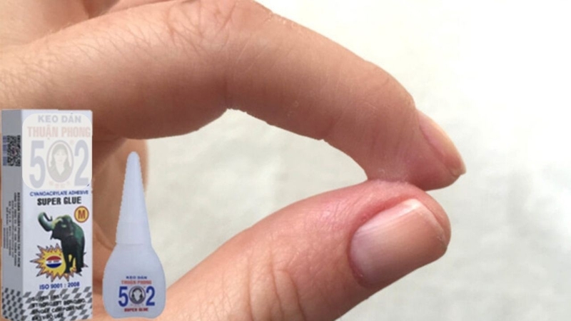 Bị keo 502 dính vào tay thường không gây nguy hiểm nếu xử lý đúng cách kịp thời