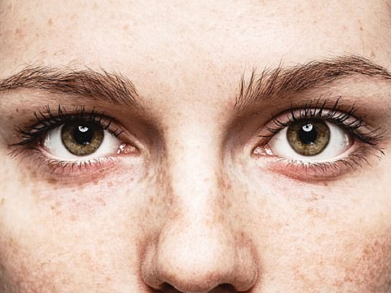 Bị khô mắt dùng thuốc gì trong điều trị 1