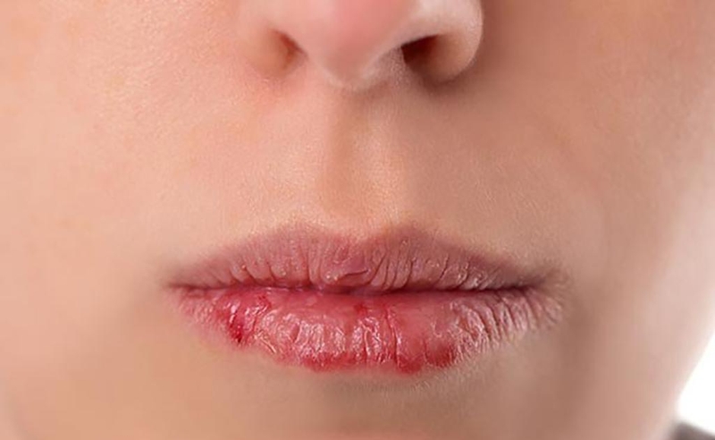 Bí kíp chống lão hóa môi làm cho đôi môi luôn căng mọng 2