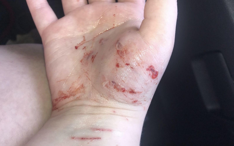 bị mèo cắn chảy máu có cần tiêm phòng không 1