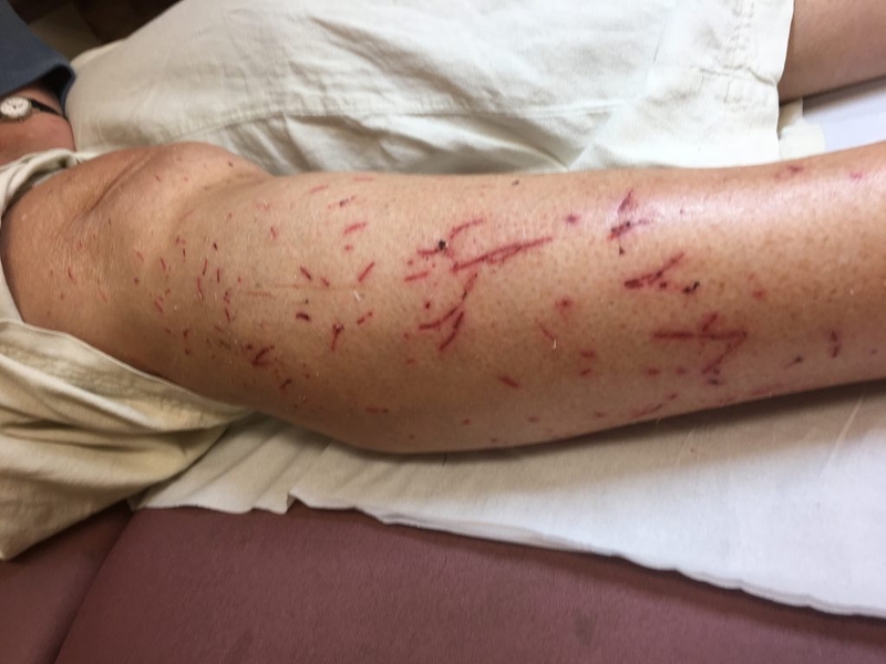 bị mèo cào chảy máu có cần tiêm phòng không 1