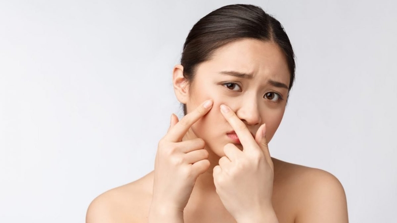 Bị mụn có nên ăn thịt bò? Cách phòng ngừa bị mụn mà bạn cần biết? 2