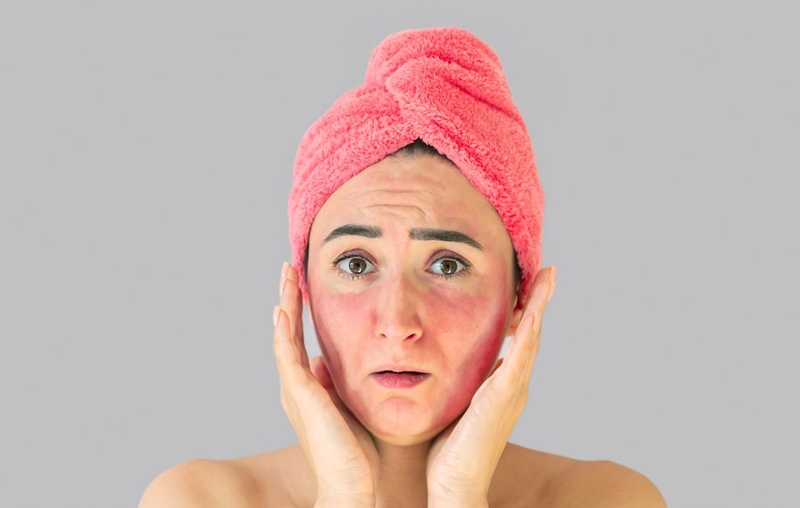 Góc làm đẹp: Bị mụn có nên đắp mặt nạ trà xanh không 3