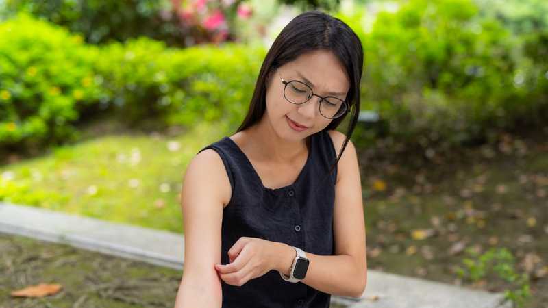 Gãi nhiều có thể làm cho vết bị muỗi đốt sưng to có mủ