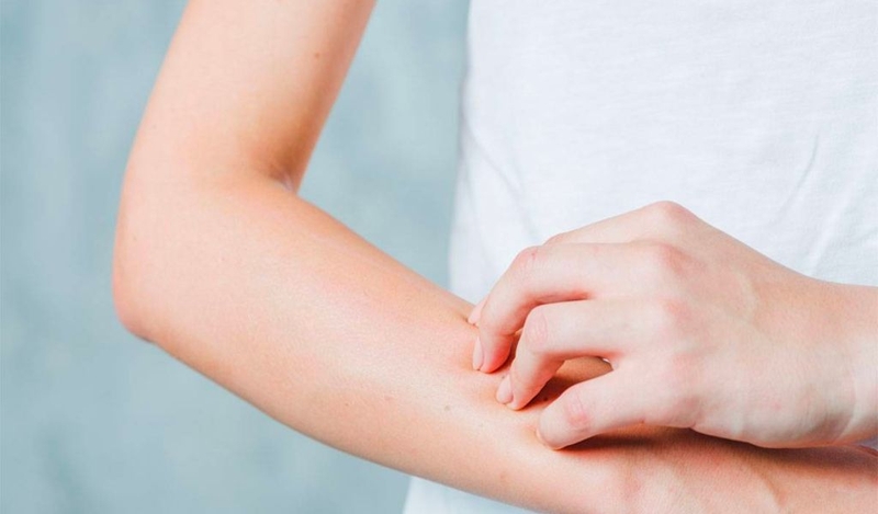 Giải mã bị ngứa khắp người không rõ nguyên nhân