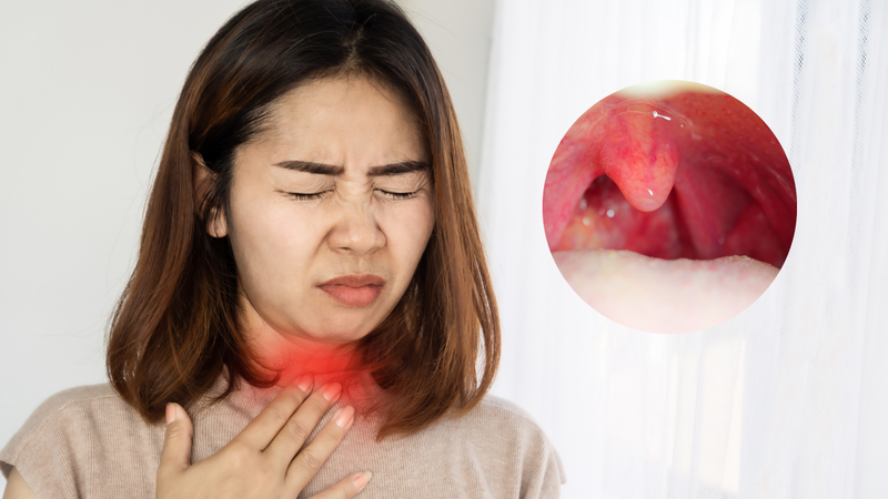 Ung thư gây nổi hạch bạch huyết