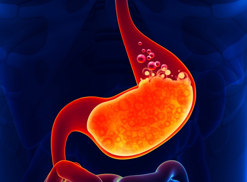 Ợ nóng nên ăn gì 1