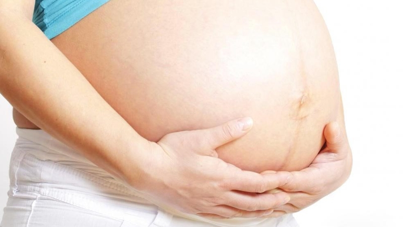 Bí quyết chọn kem chống rạn da cho bà bầu 1