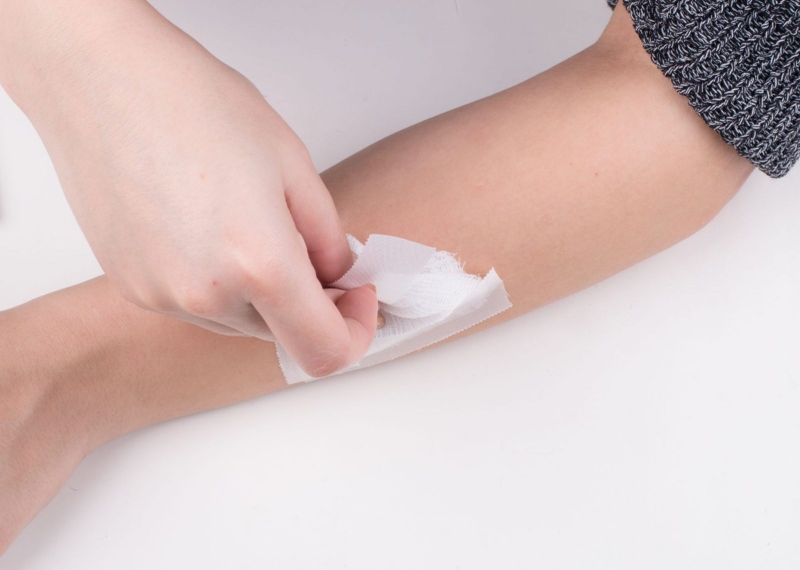 Bí quyết trị hắc lào bằng rượu cực hiệu quả, an toàn 1