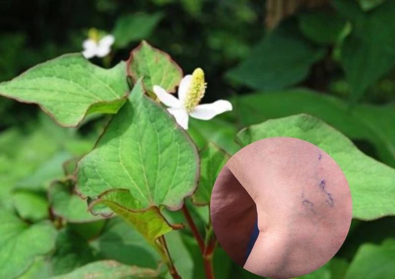 Bí quyết uống rau diếp cá trị giãn tĩnh mạch bồi bổ sức khỏe 3