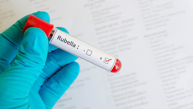 Bị Rubella rồi có bị lại không? Những phương pháp phòng ngừa Rubella hiệu quả 3