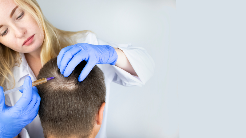 Tiêm Corticosteroid trực tiếp vào vùng rụng tóc để kích thích mọc lại