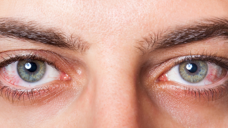 Bị sẹo giác mạc có chữa được không?-2