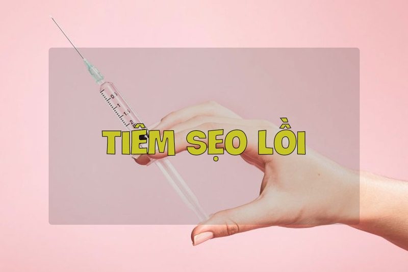 Bị sẹo lồi ở đầu gối phải làm sao? 4
