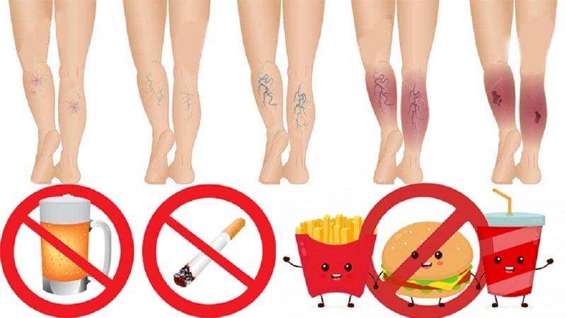 Bị suy giãn tĩnh mạch có nên tập yoga không? Một số động tác yoga cho người suy giãn tĩnh mạch 6