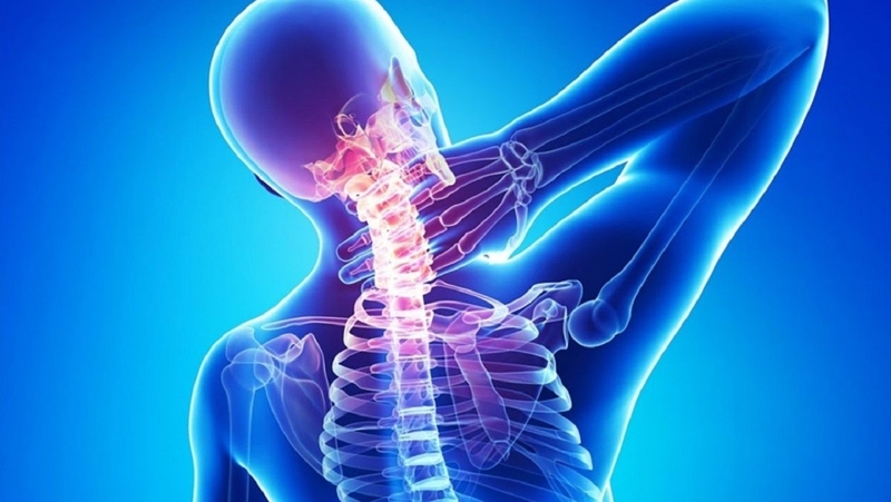 Bị thoái hóa đốt sống cổ uống glucosamine có hiệu quả không? 1