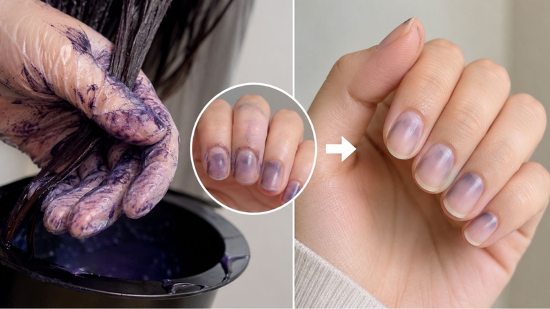 Bị thuốc nhuộm dính vào móng tay có thể khiến móng đổi màu tạm thời