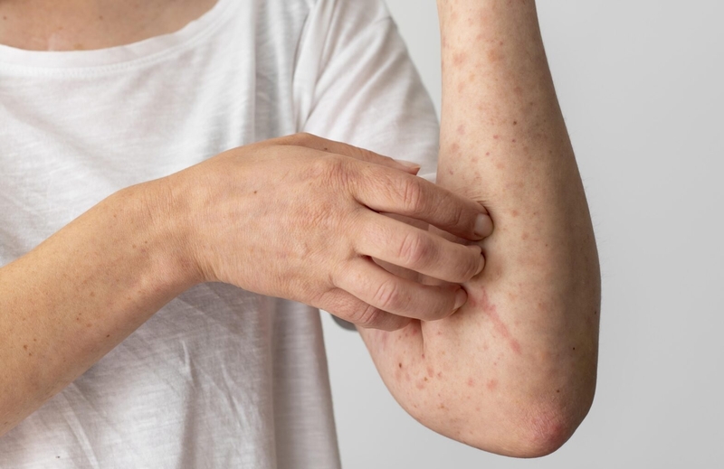 Bị thủy đậu uống nước yến được không 3