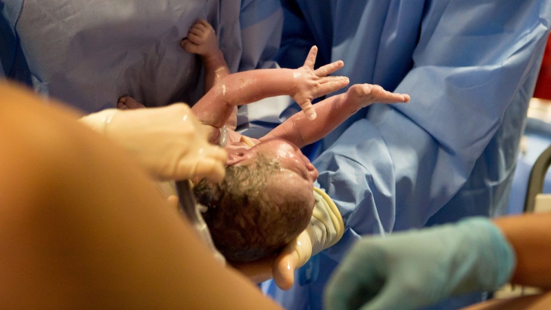 Bị tiền sản giật có đẻ thường được không? 3