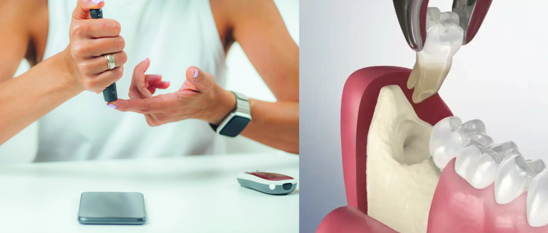 bi-tieu-duong-co-nho-rang-duoc-khong-va-nhung-dieu-can-luu-y-ve-cach-cham-soc-rang-mieng-cua-nguoi-benh 2.png