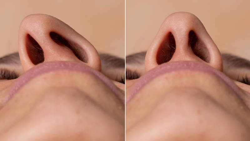 Bị vướng đờm ở cổ họng: Làm gì để khắc phục? 2