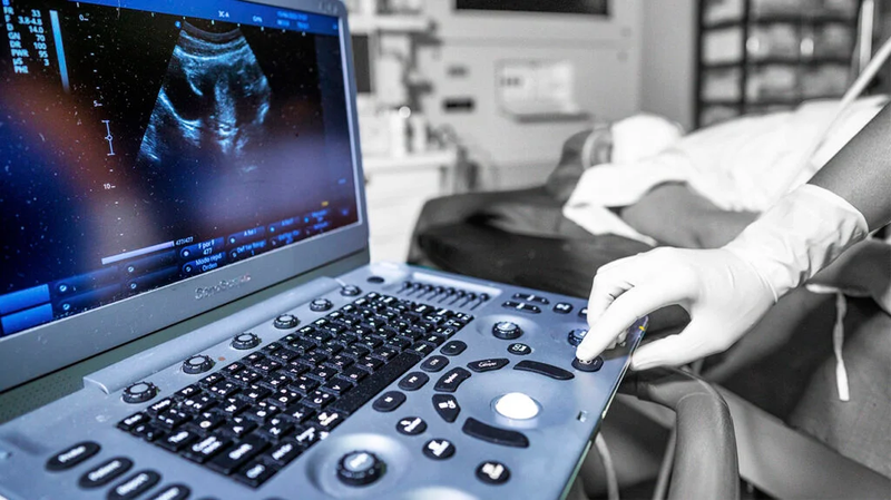 Biến chứng của cắt u nang buồng trứng 4