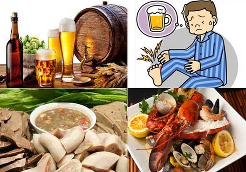 Biến chứng của Gout nguy hiểm như thế nào?