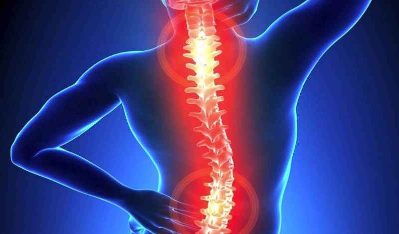 Biến chứng của viêm cột sống dính khớp và cách điều trị 2