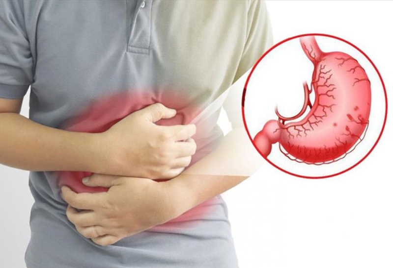 Biến chứng của xuất huyết dạ dày và những điều cần biết  1