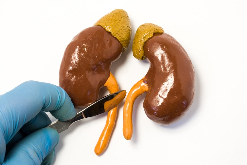 Biến chứng sau mổ sỏi niệu quản và những lưu ý cần biết 2