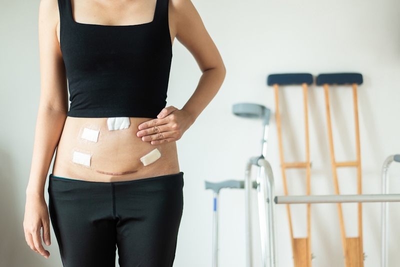 Biến chứng sau mổ sỏi niệu quản và những lưu ý cần biết 4