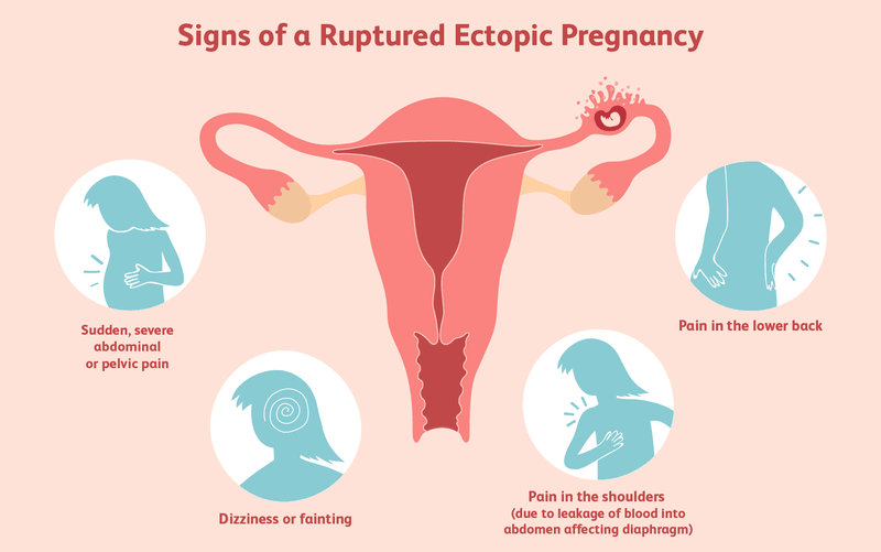 Biến chứng sau mổ thai ngoài tử cung - Chăm sóc sau phẫu thuật như thế nào? 3