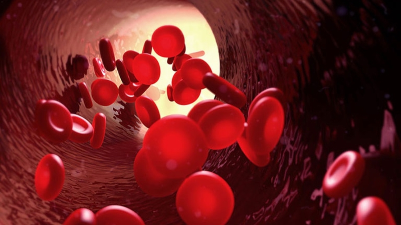 Biến chứng sau thay khớp háng và những điều cần lưu ý 2