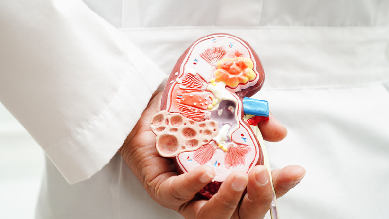 Biến chứng thận là một trong những tổn thương nghiêm trọng và thường gặp ở người mắc lupus ban đỏ hệ thống