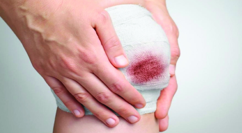 Biến chứng và mối nguy hiểm từ vết thương hở 1